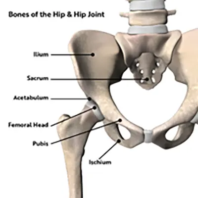 Ischiofemoral Impingement - Benjamin Domb MD