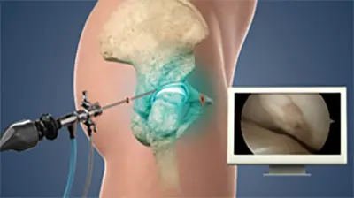 Surgical Treatments - Benjamin Domb MD