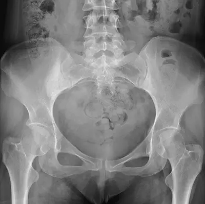 Xray/MRI Review - 1 - Educational Photo