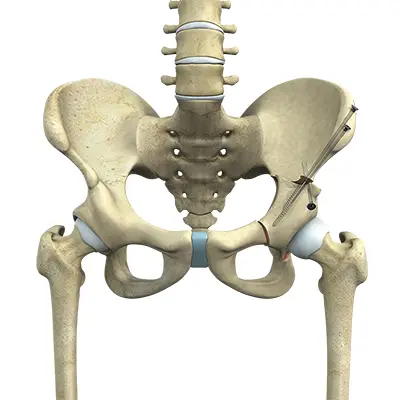 Surgical Options - Benjamin Domb MD