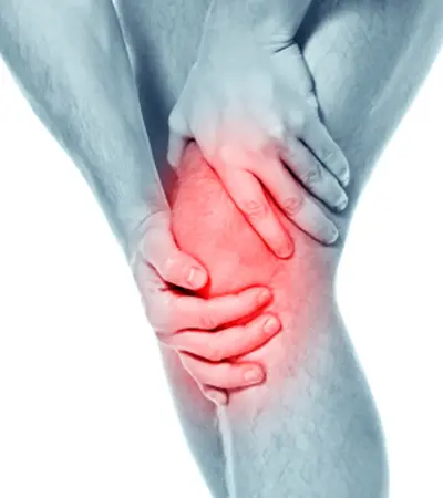ACL Tear - 3 - Educational Photo