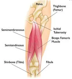 Proximal Hamstring Tear logo