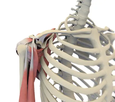 Shoulder Pain - 2 - Educational Photo